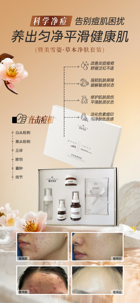 源文件下载【享设计】搜索编号：35130036578483917【美业护肤品祛痘舒缓修护套盒功效海报】