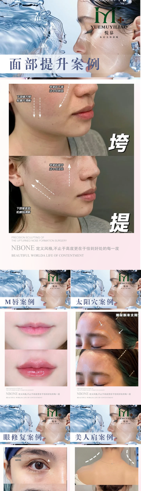 源文件下载【享设计】搜索编号：54890036450788373【医美案例】