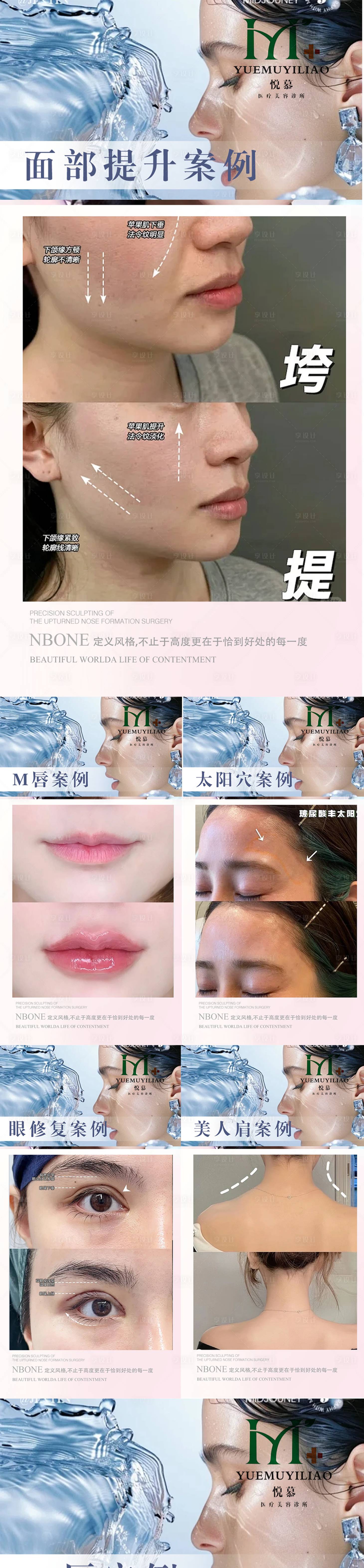 源文件下载【享设计】搜索编号：54890036450788373【医美案例】