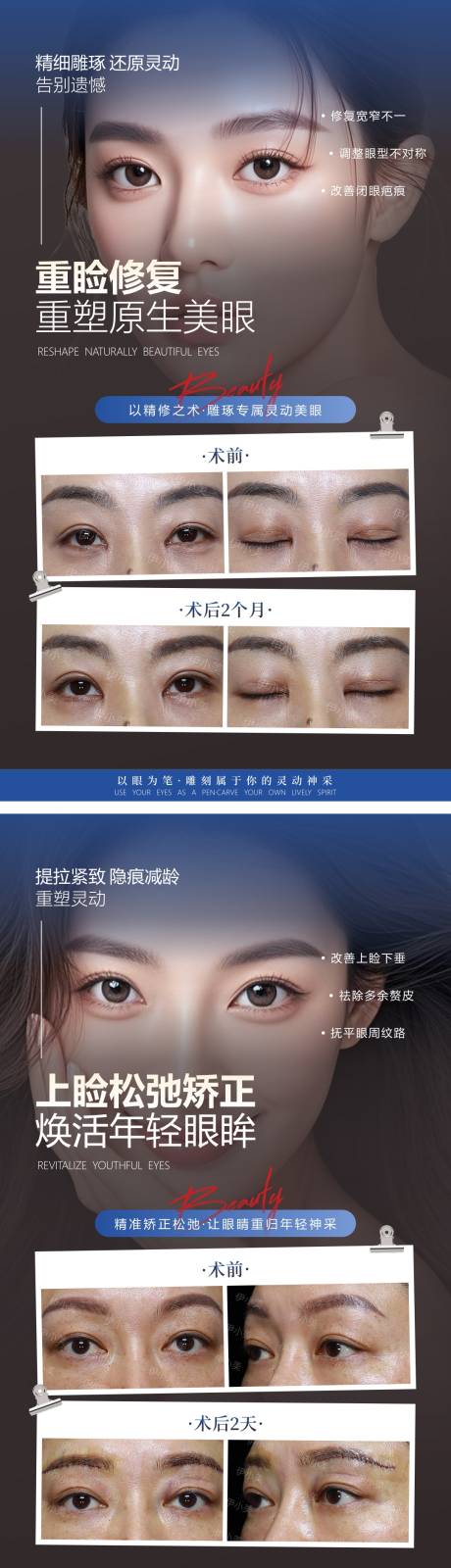 源文件下载【享设计】搜索编号：28210036224063996【医美特色项目海报案例对比】
