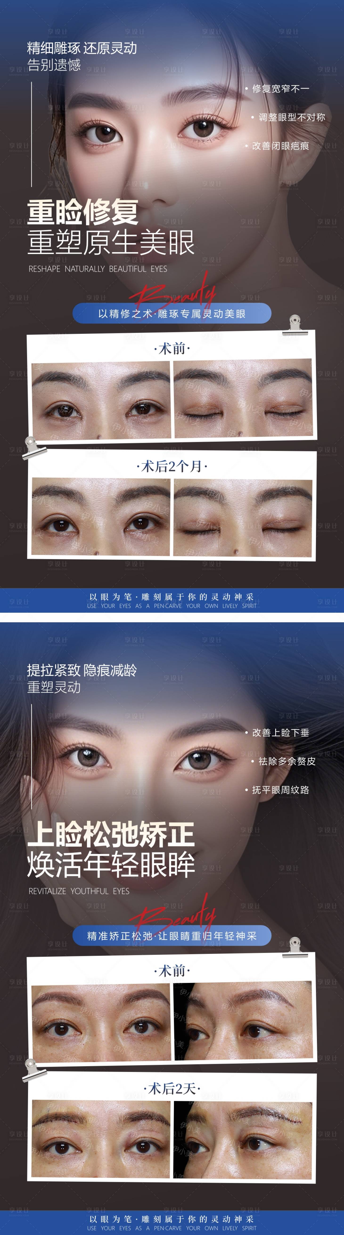 源文件下载【享设计】搜索编号：28210036224063996【医美特色项目海报案例对比】