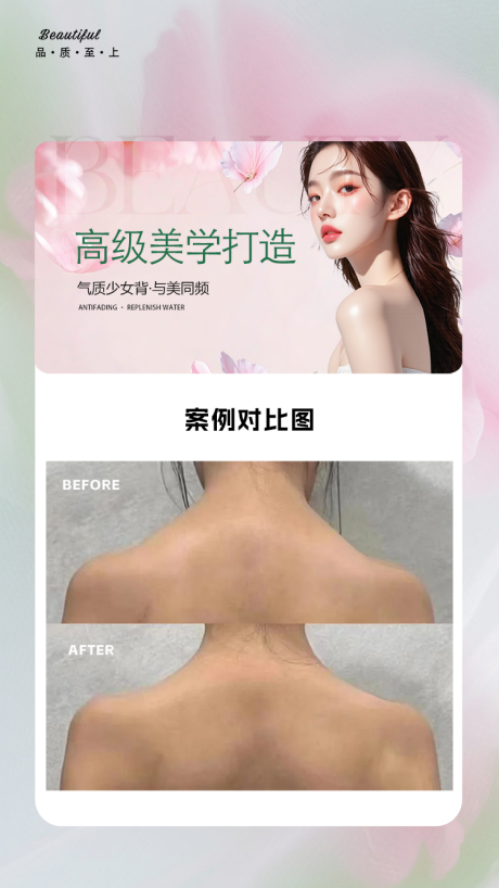 源文件下载【享设计】搜索编号：12660036208597387【美背案例海报】