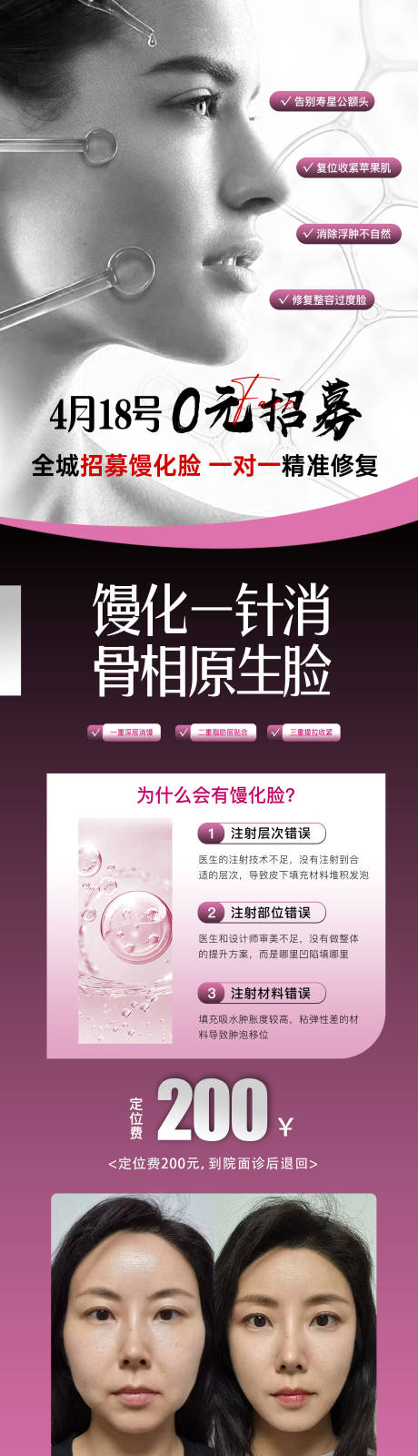 源文件下载【享设计】搜索编号：36230036186844153【医美拯救馒化脸海报】