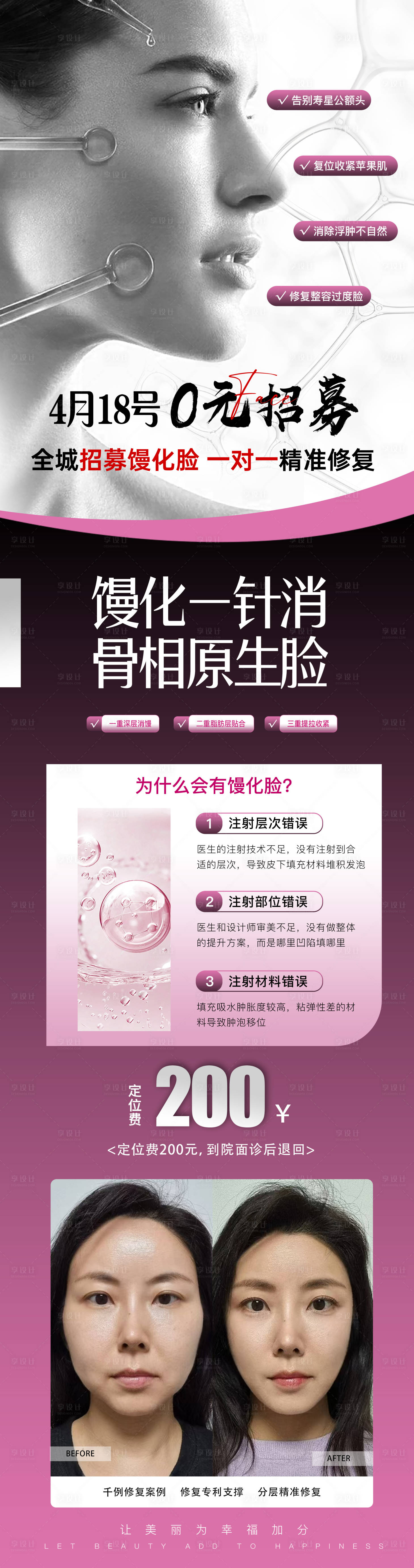 源文件下载【享设计】搜索编号：36230036186844153【医美拯救馒化脸海报】