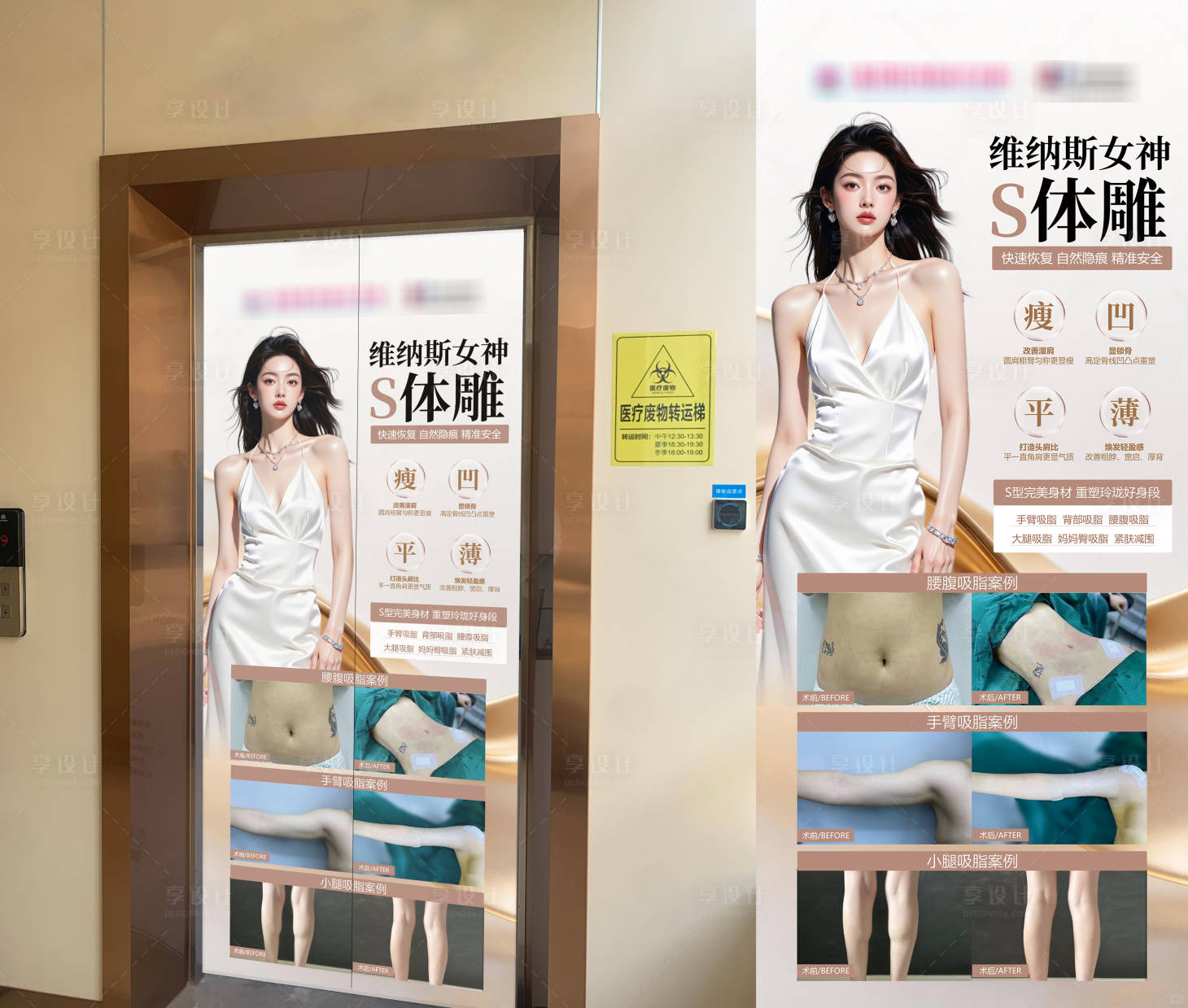 源文件下载【享设计】搜索编号：64140036438725028【医美电梯案例广告】