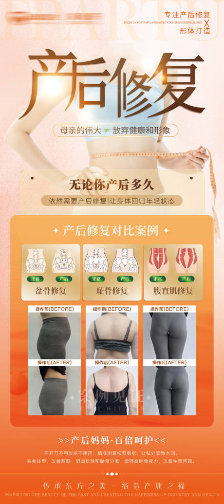 源文件下载【享设计】搜索编号：43060036548404200【产后修复】
