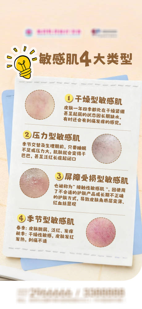 源文件下载【享设计】搜索编号：33220036330377187【敏感肌4大类型海报】