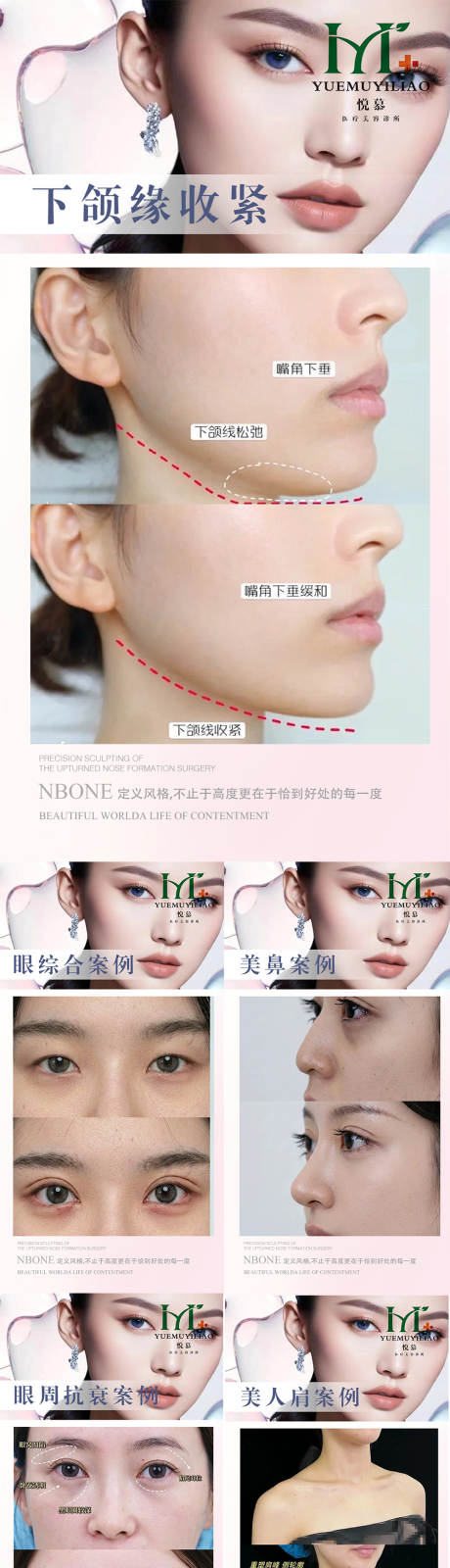 源文件下载【享设计】搜索编号：85720036450777962【医美案例】