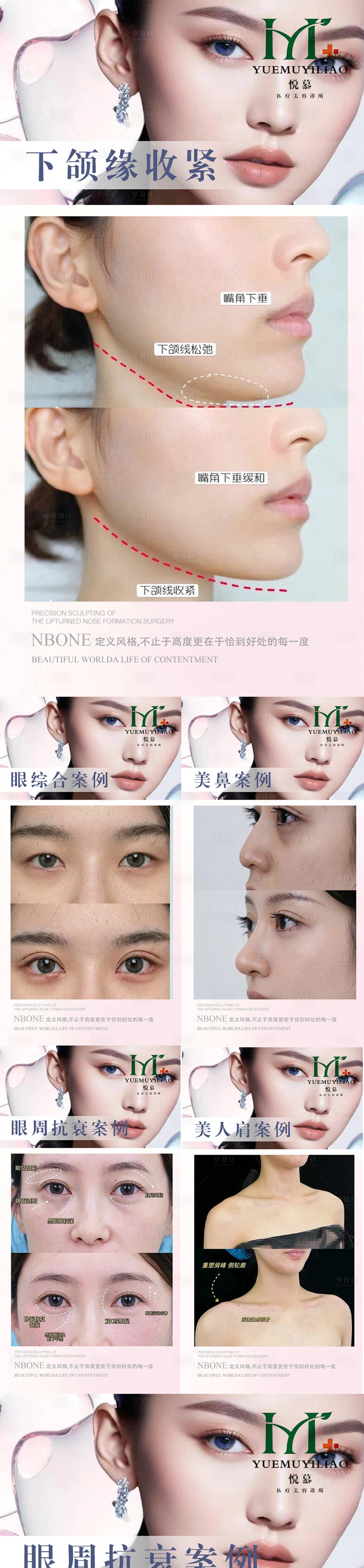 源文件下载【享设计】搜索编号：85720036450777962【医美案例】
