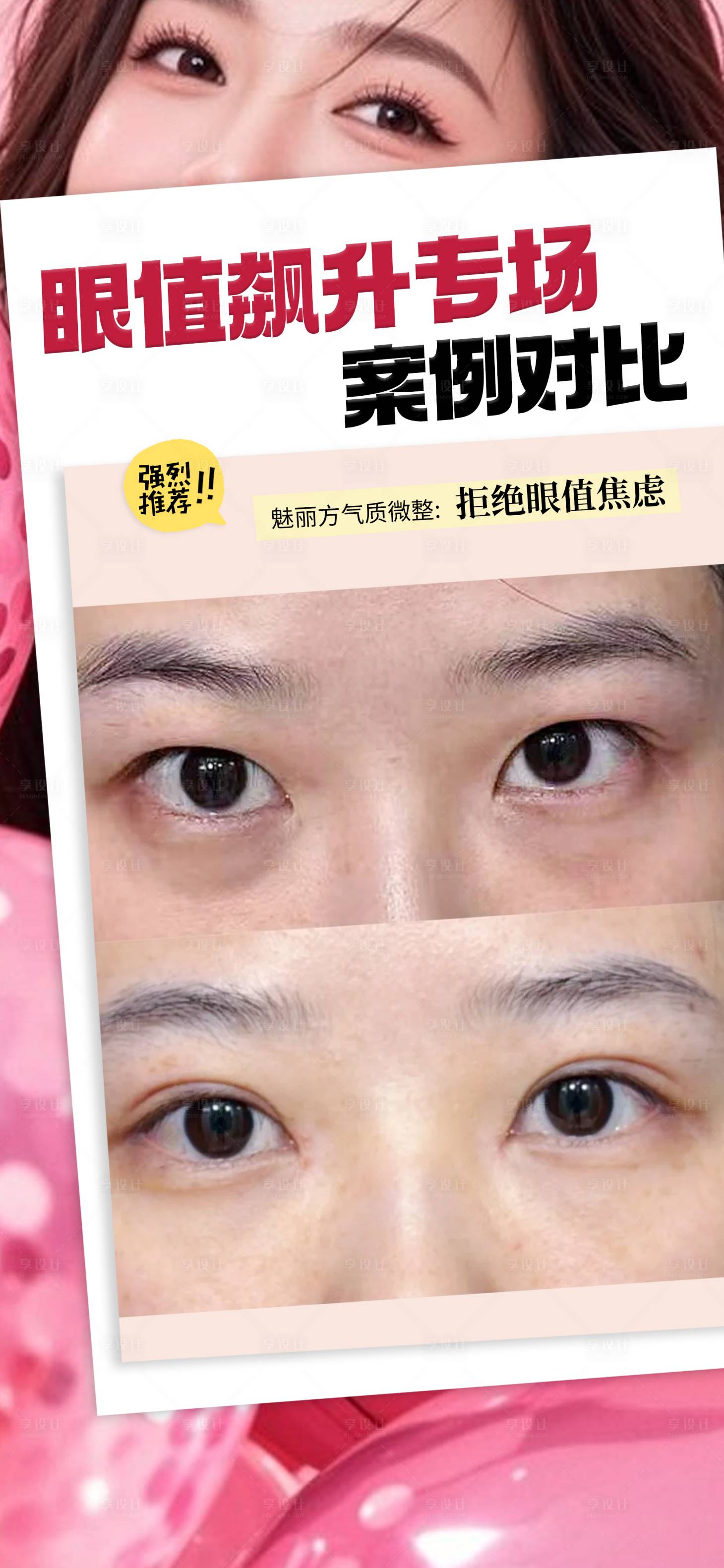 源文件下载【享设计】搜索编号：90830036208729103【精致双眼皮海报】