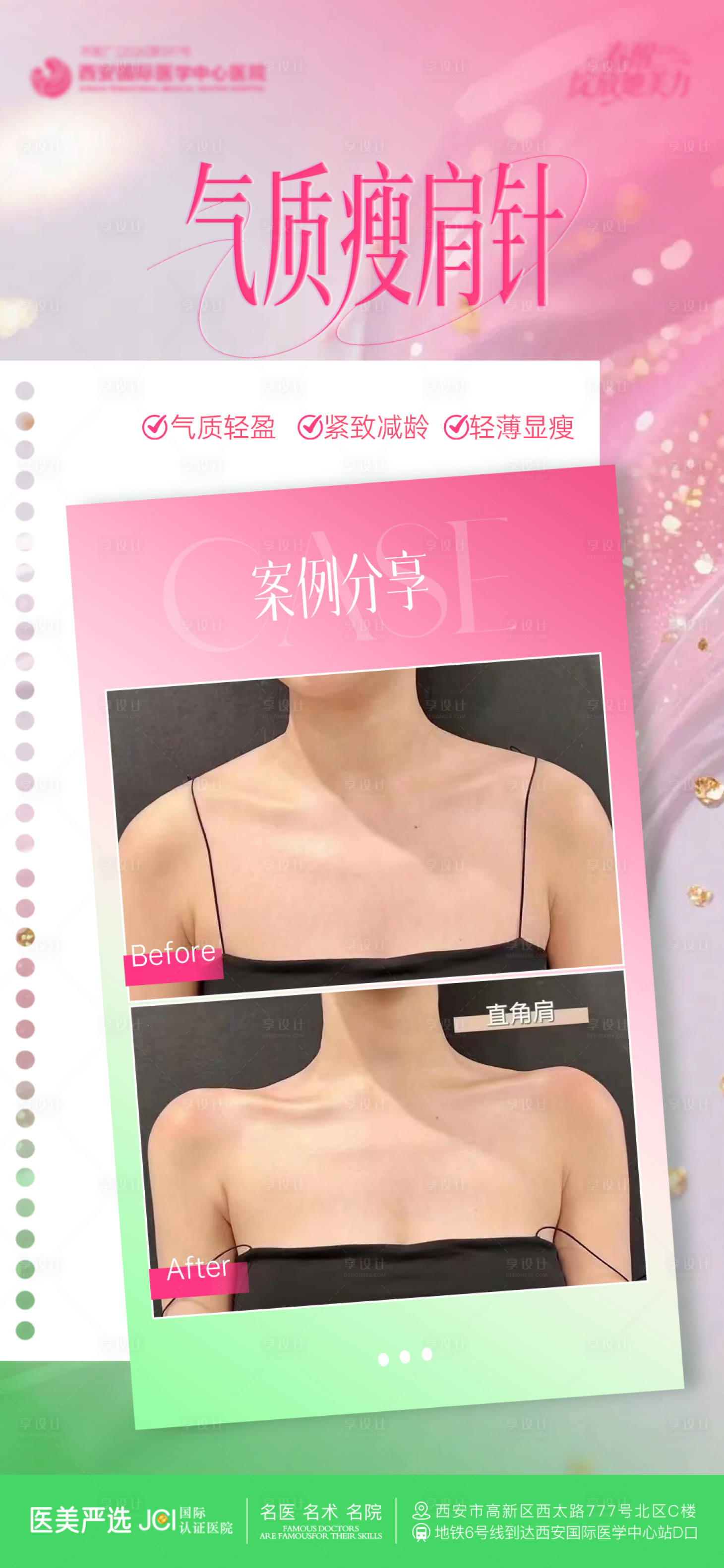 源文件下载【享设计】搜索编号：65950036512312100【瘦肩案例医美海报】
