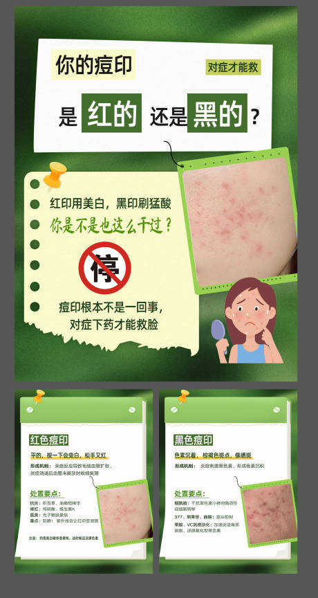源文件下载【享设计】搜索编号：97750036211405951【你的痘印是红的还是黑的-小红书】