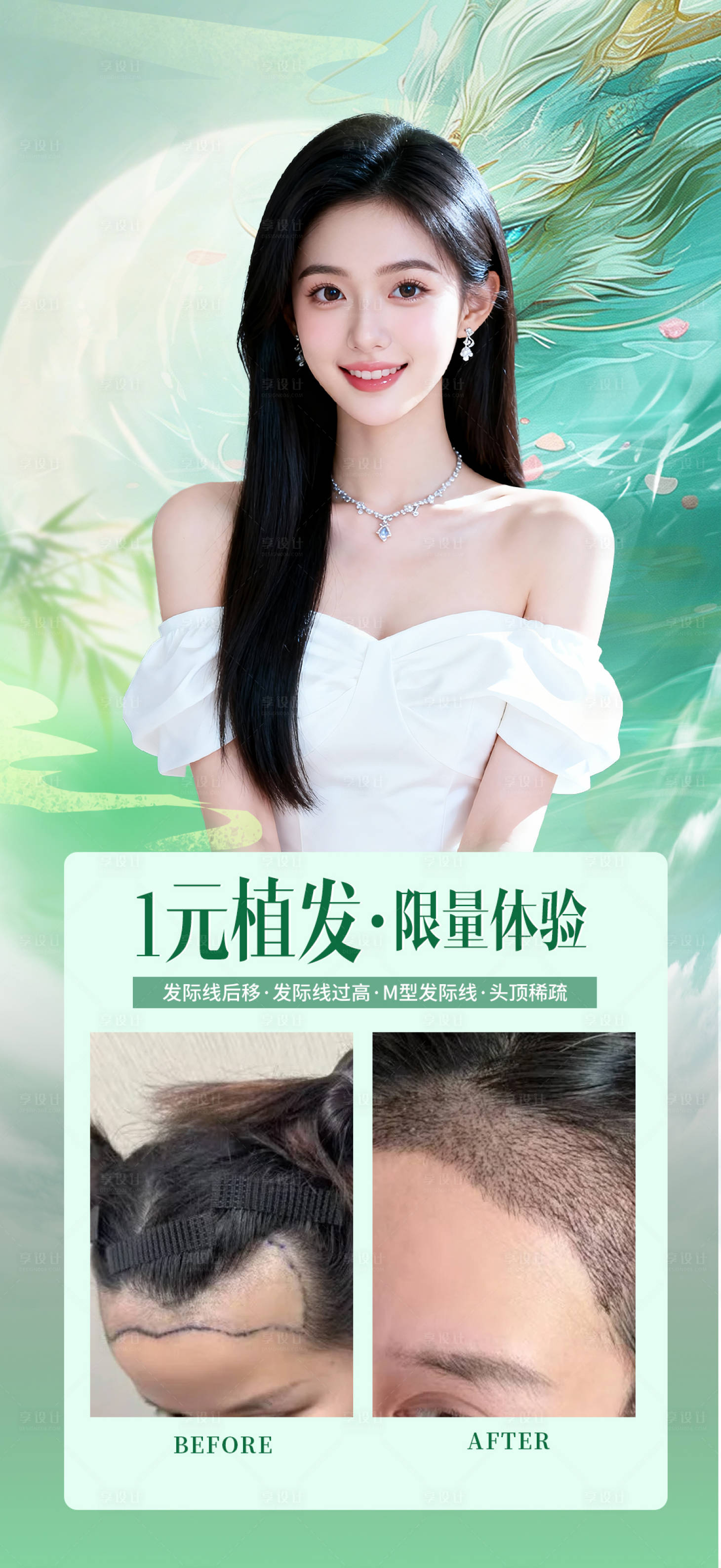 源文件下载【享设计】搜索编号：37810036298145703【植发案例】