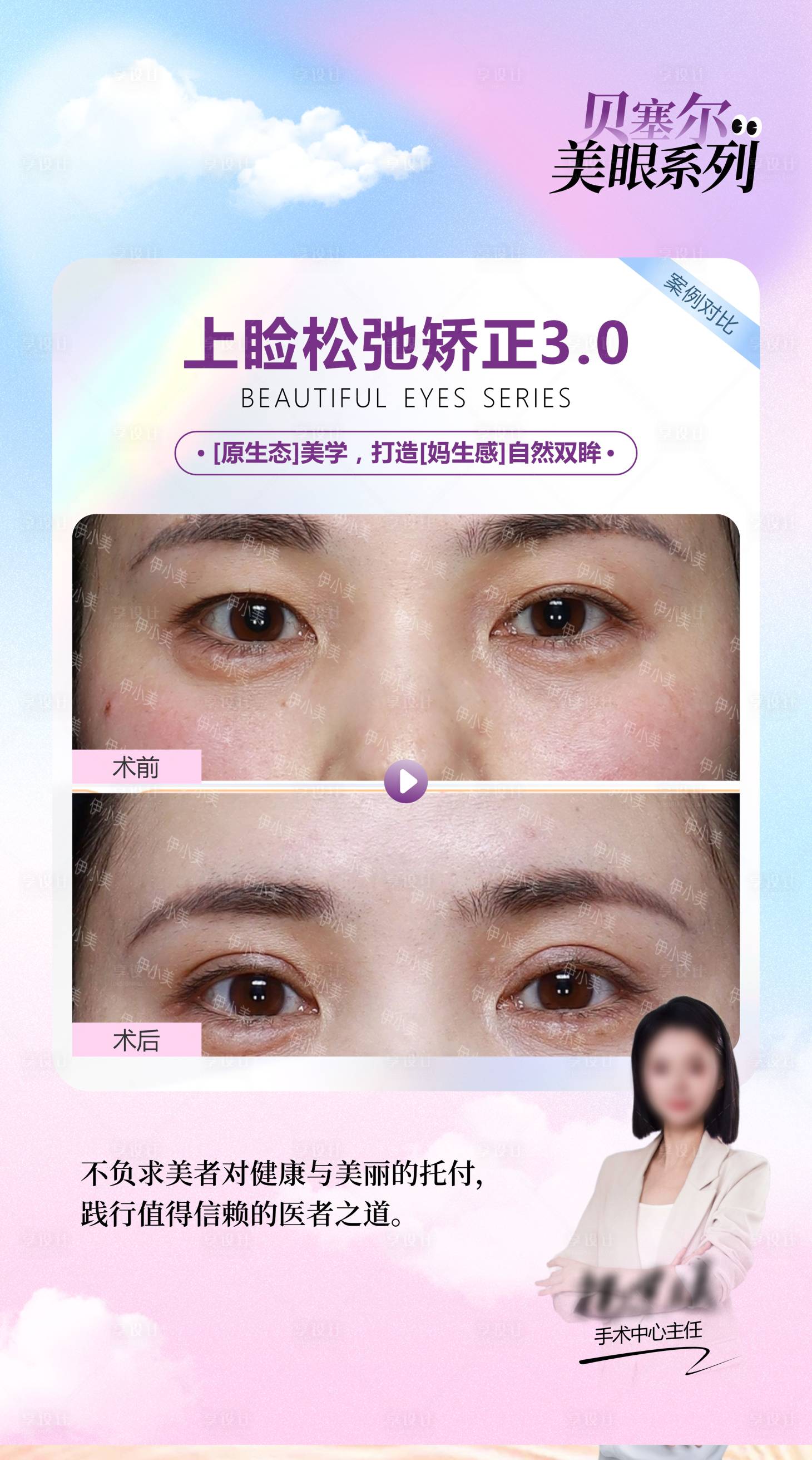 源文件下载【享设计】搜索编号：28010036224027118【医美案例对比图模板】