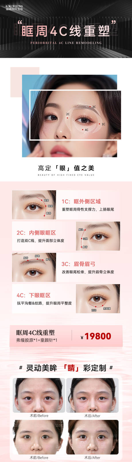 源文件下载【享设计】搜索编号：53940036176187571【眼周4C】