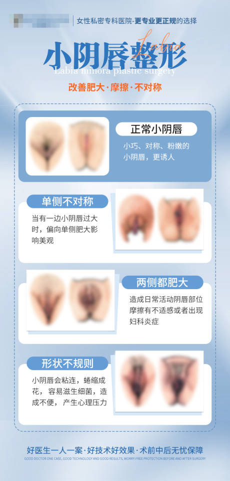 源文件下载【享设计】搜索编号：86720036236537070【阴唇自测表】