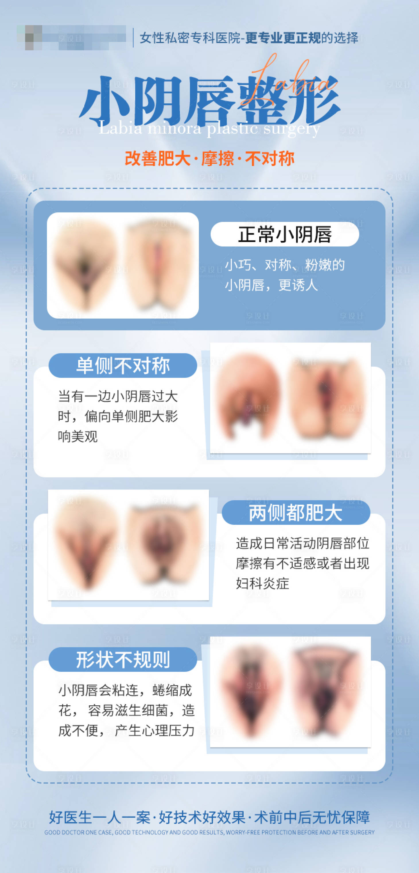源文件下载【享设计】搜索编号：86720036236537070【阴唇自测表】