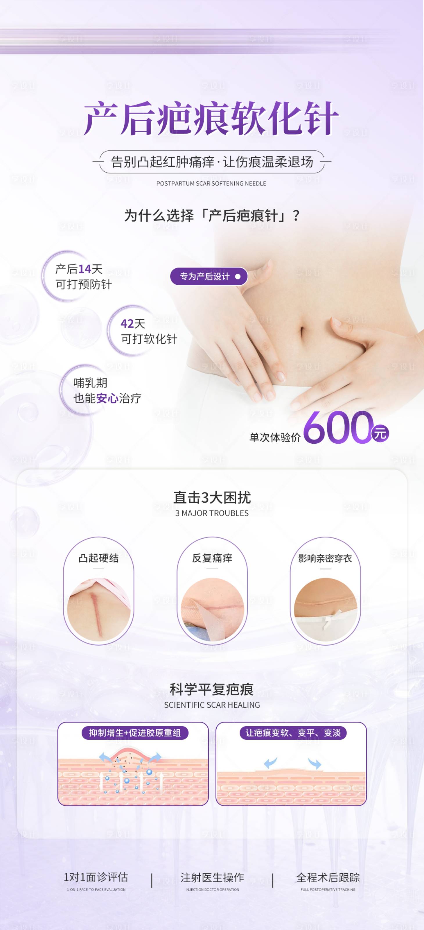 源文件下载【享设计】搜索编号：43500036500217051【产后疤痕针】