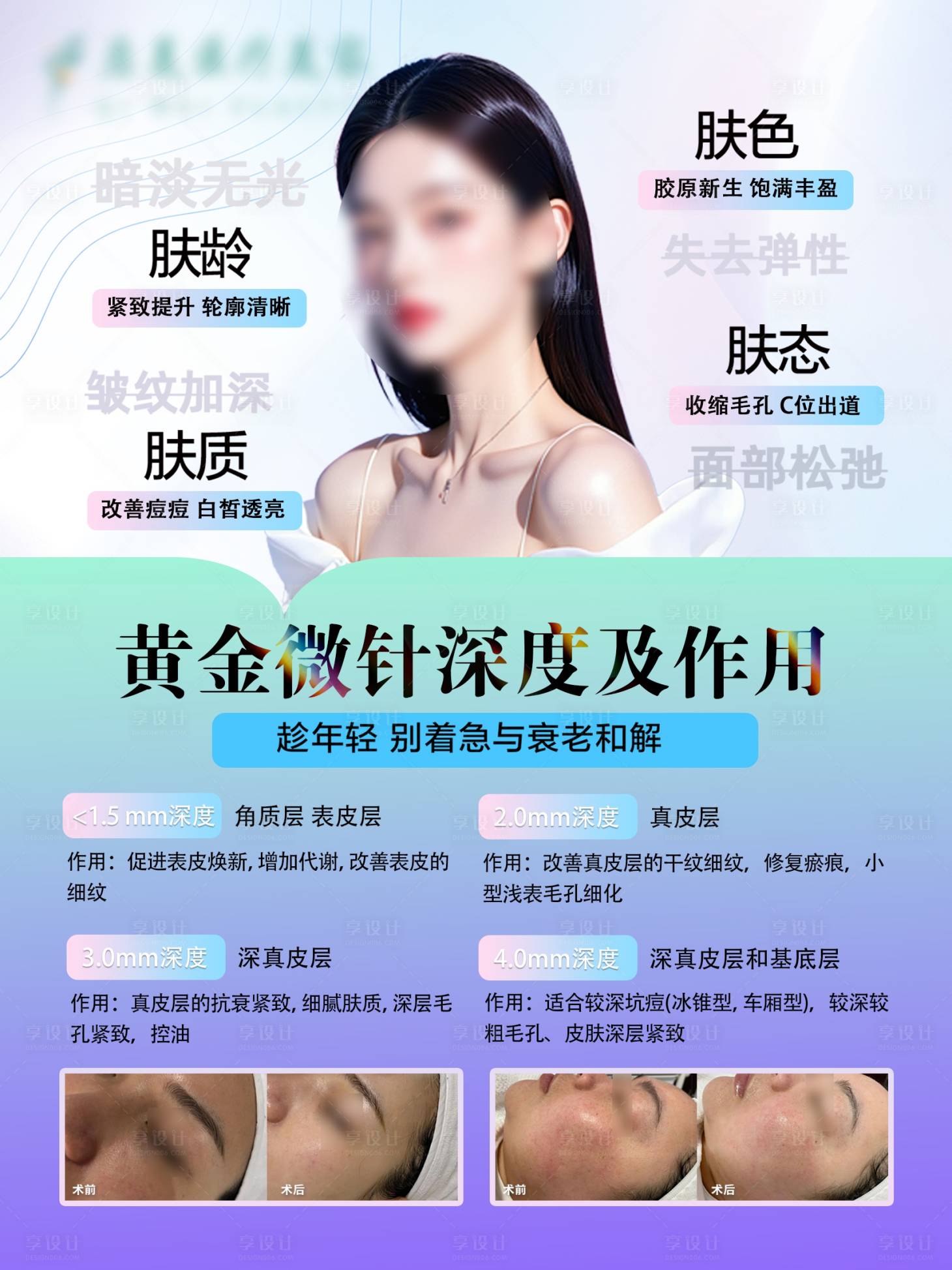 源文件下载【享设计】搜索编号：68950036627495531【黄金微针微针美肤海报补水】