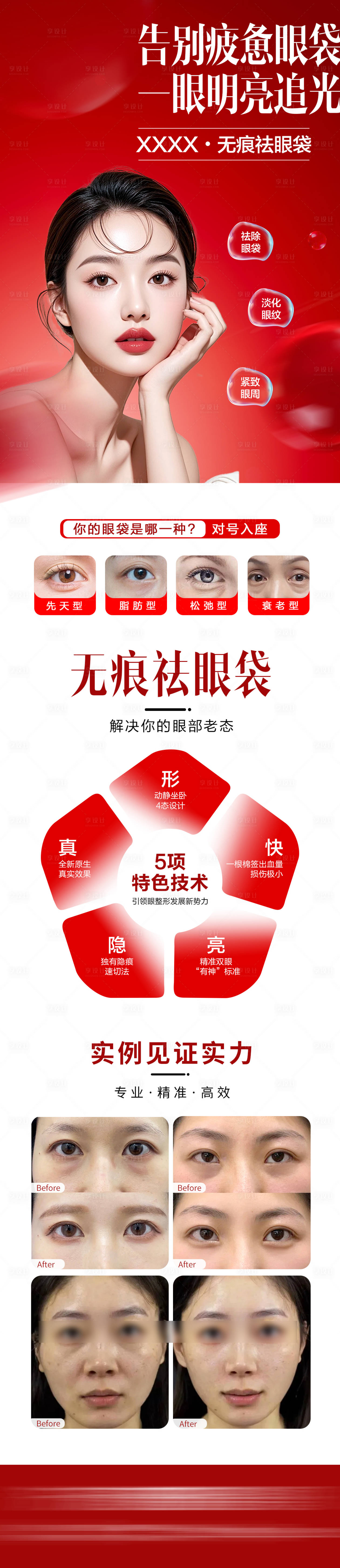 源文件下载【享设计】搜索编号：93250036626199177【医美无痕祛眼袋海报】