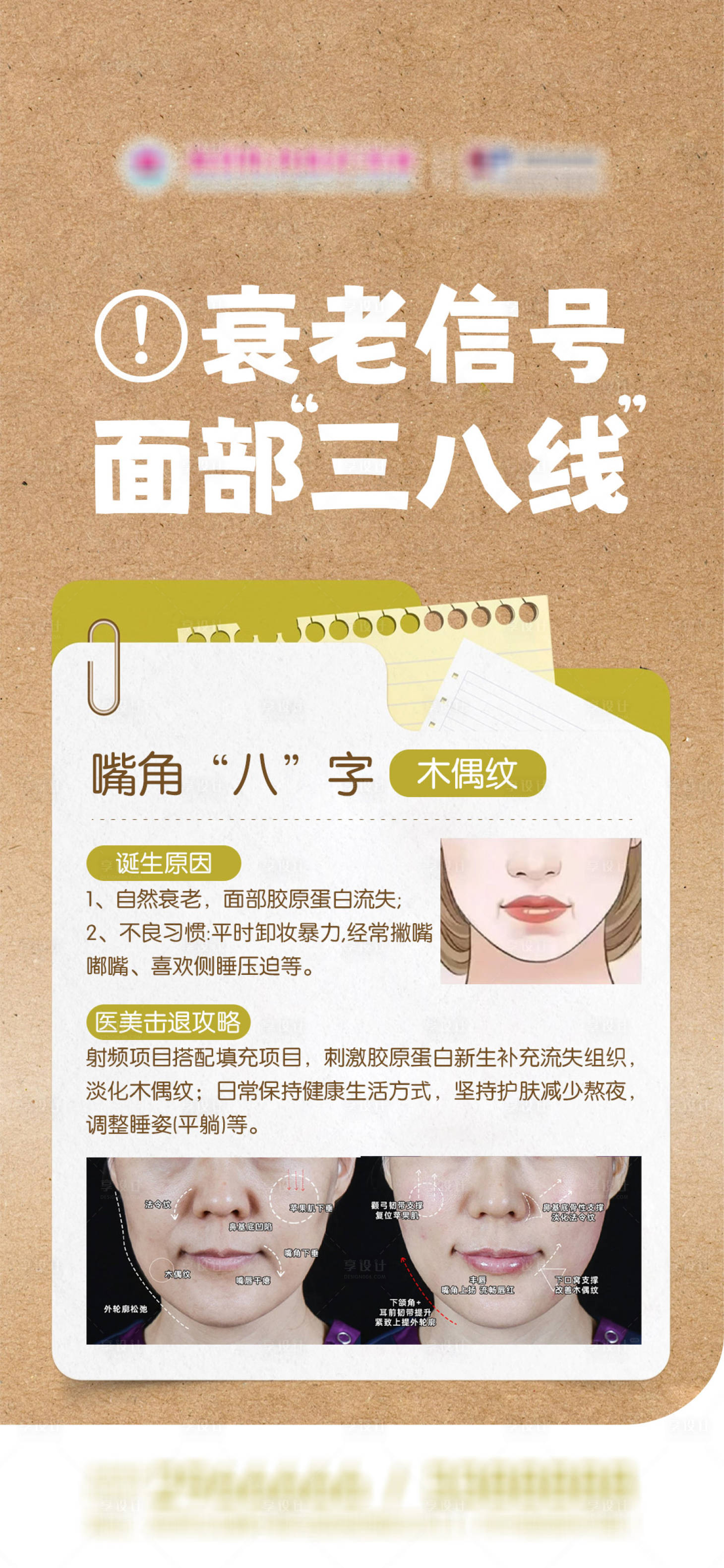 源文件下载【享设计】搜索编号：23060036369454181【医美科普衰老信号面部三八线】