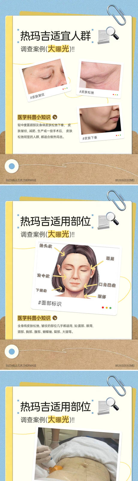 源文件下载【享设计】搜索编号：44060036164148476【热玛吉科普图】