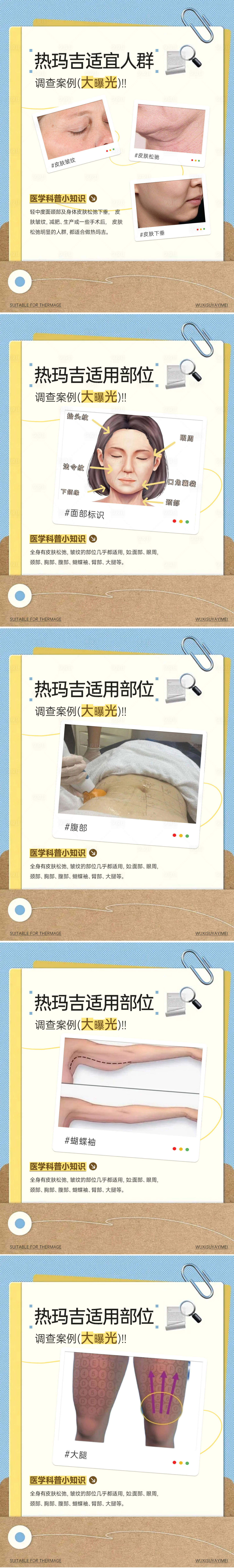 源文件下载【享设计】搜索编号：44060036164148476【热玛吉科普图】