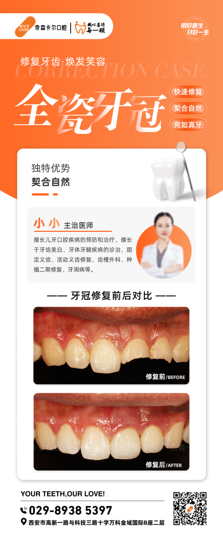 源文件下载【享设计】搜索编号：82720036403363212【牙齿修复案例】