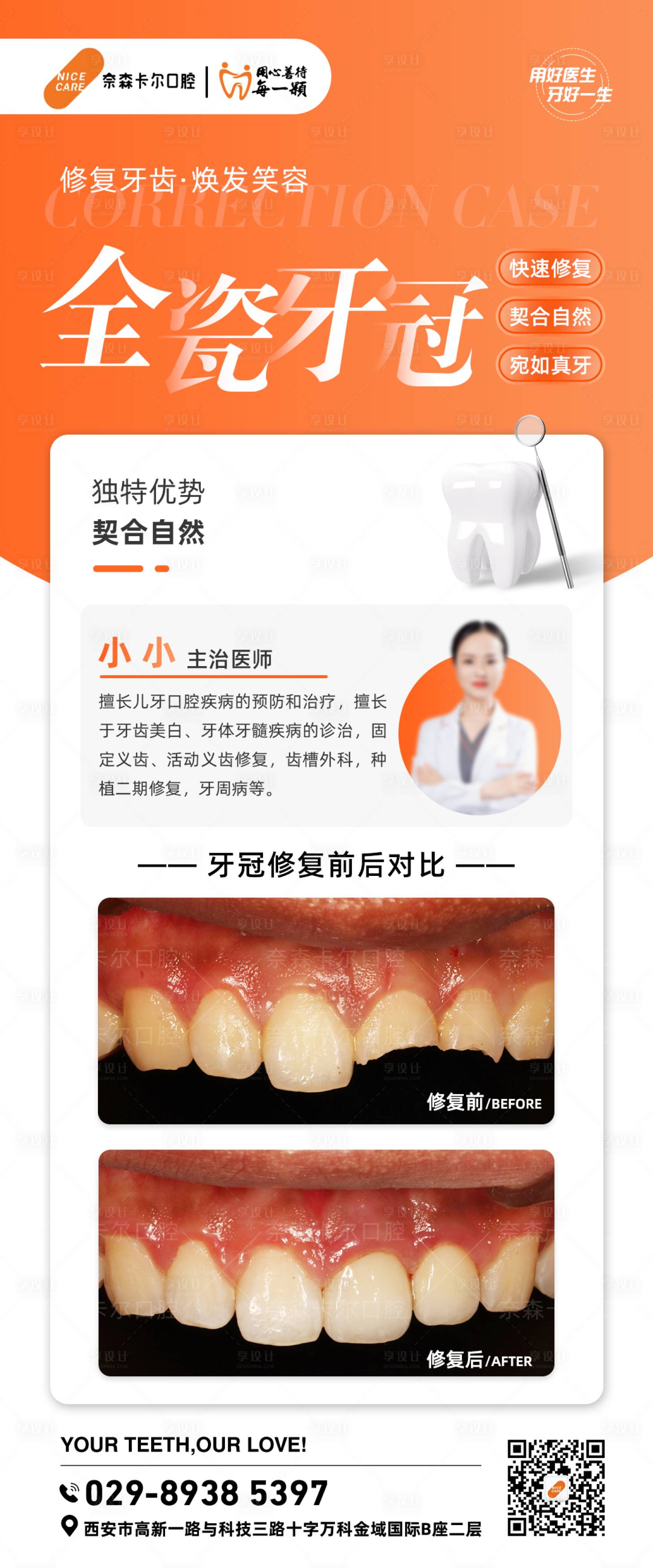 源文件下载【享设计】搜索编号：82720036403363212【牙齿修复案例】