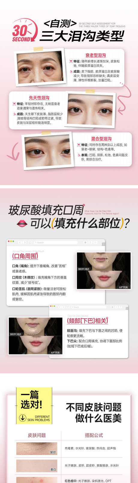源文件下载【享设计】搜索编号：92770036266029971【医美小红书海报 】