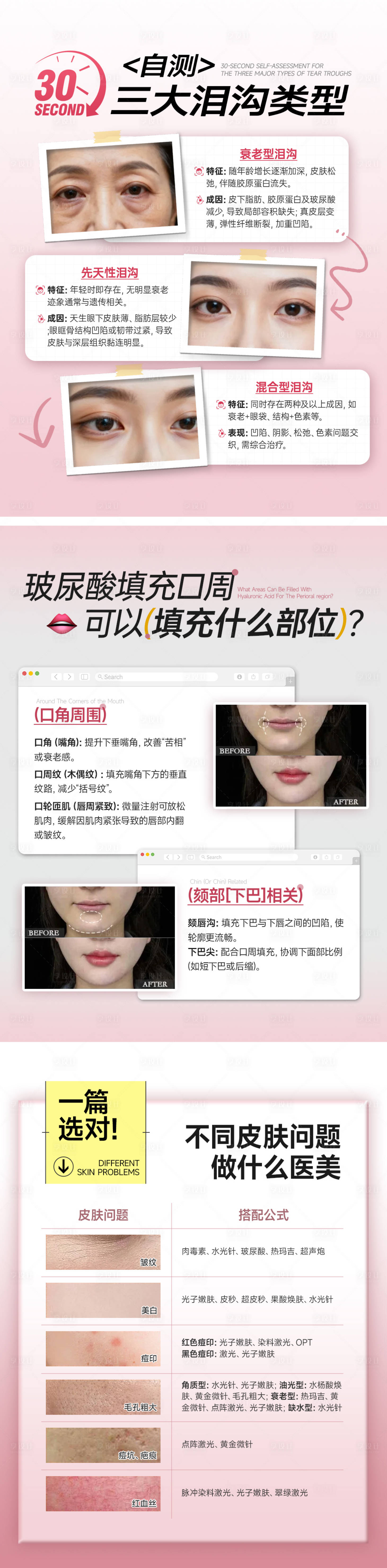 源文件下载【享设计】搜索编号：92770036266029971【医美小红书海报 】