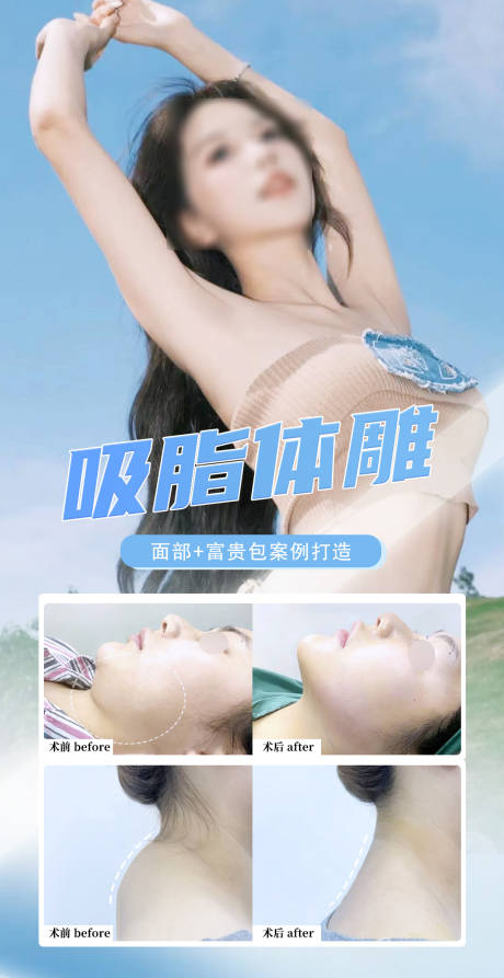 源文件下载【享设计】搜索编号：54030036349855525【吸脂体雕塑形案例】