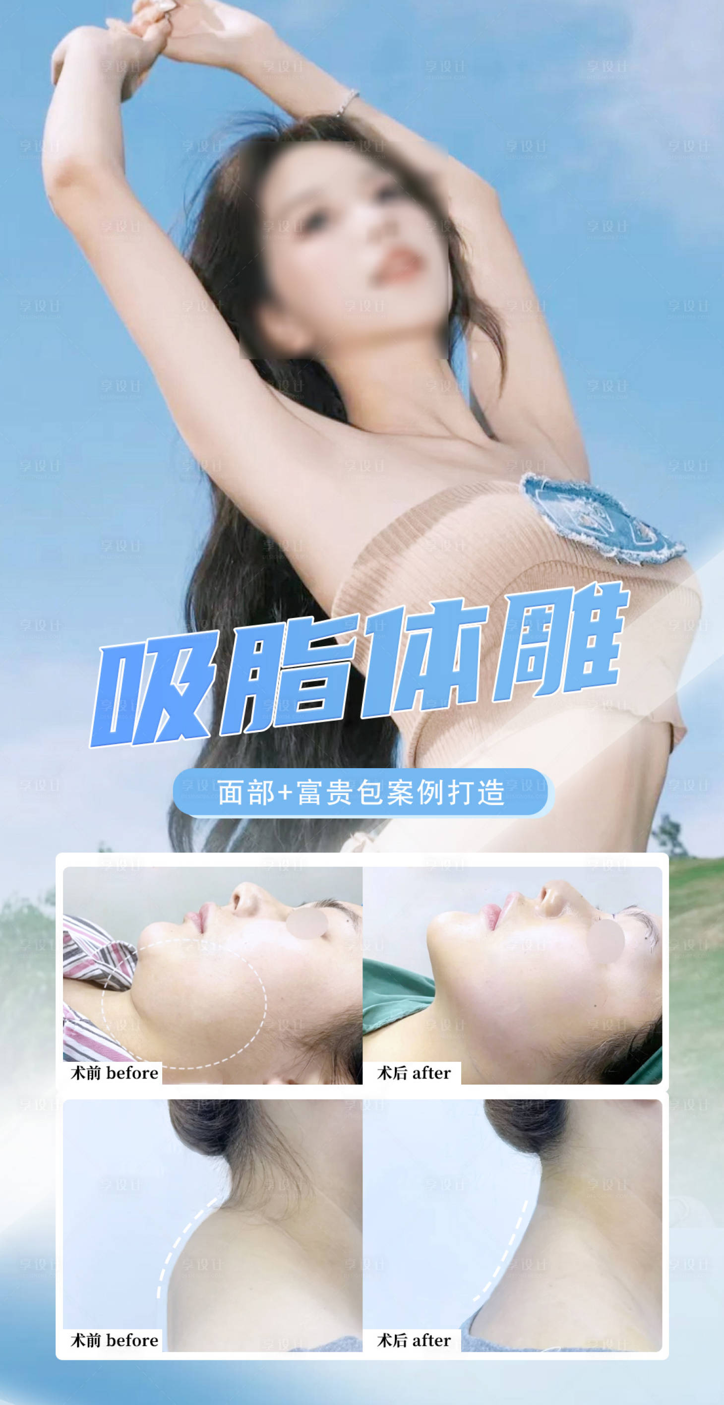 源文件下载【享设计】搜索编号：54030036349855525【吸脂体雕塑形案例】