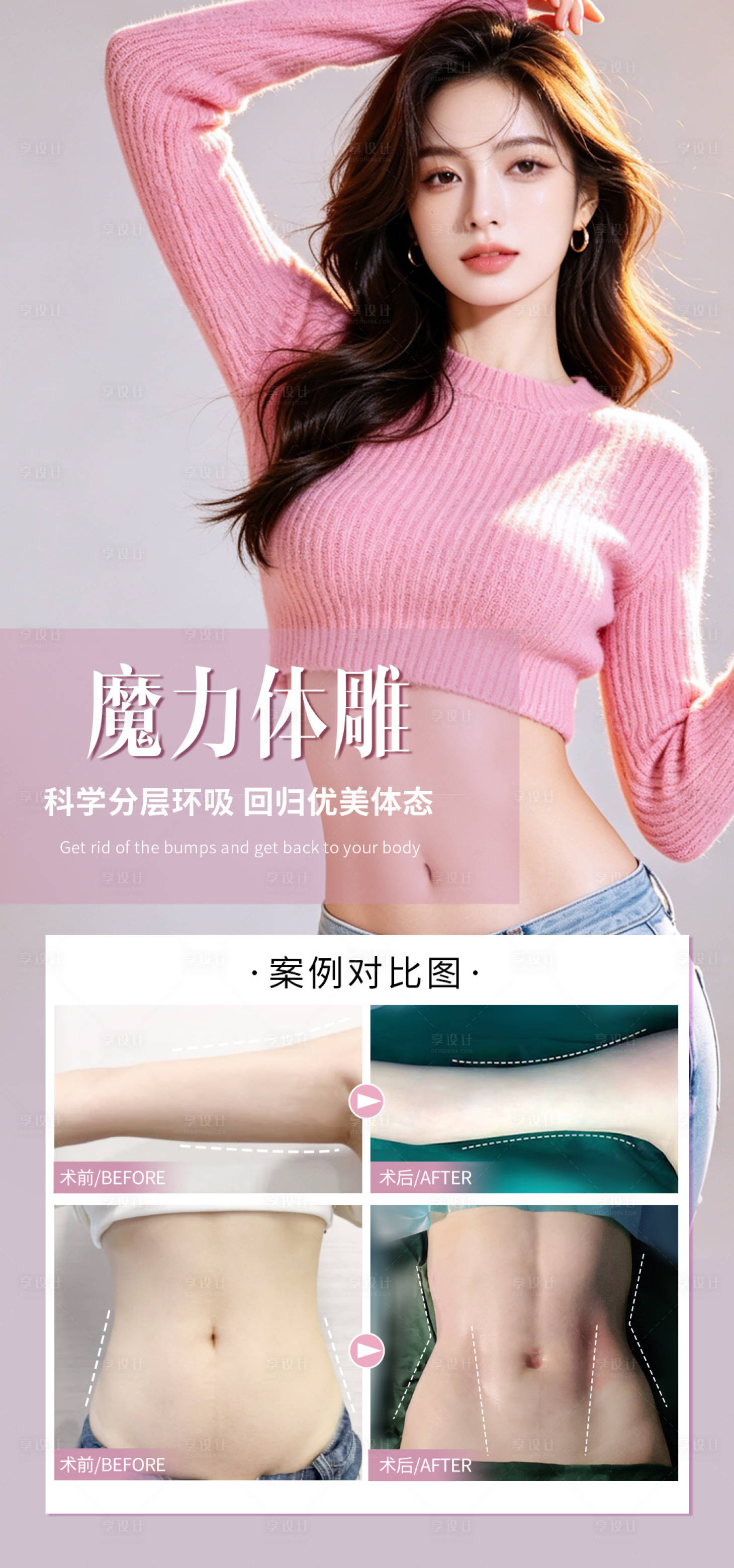 源文件下载【享设计】搜索编号：74070036442545650【魔力体雕吸脂塑形手术案例海报】