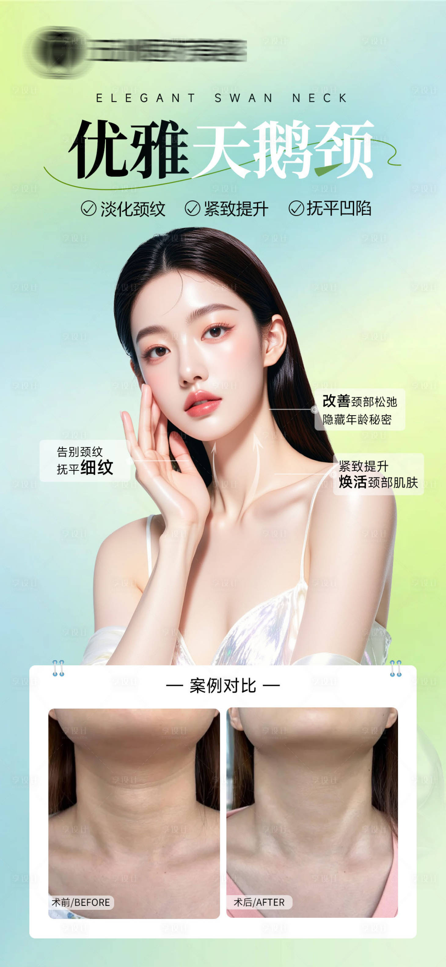 源文件下载【享设计】搜索编号：10670036415521391【医美案例对比】