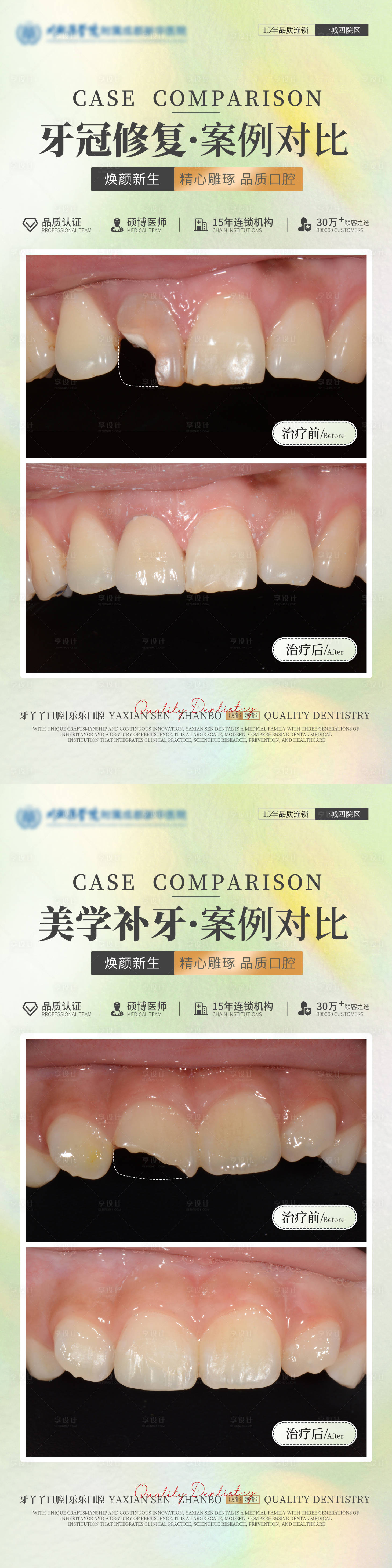 源文件下载【享设计】搜索编号：97130036173649833【医美口腔案例海报】