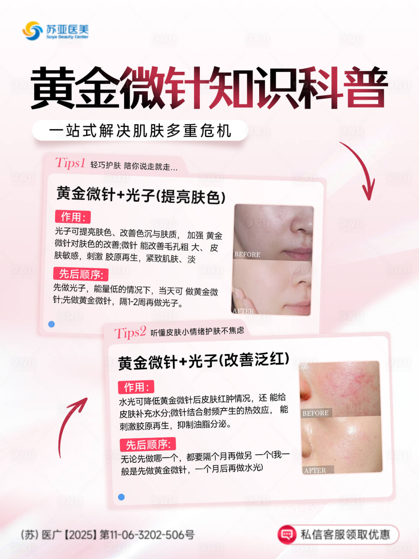 源文件下载【享设计】搜索编号：21770036350718211【黄金微针知识科普】