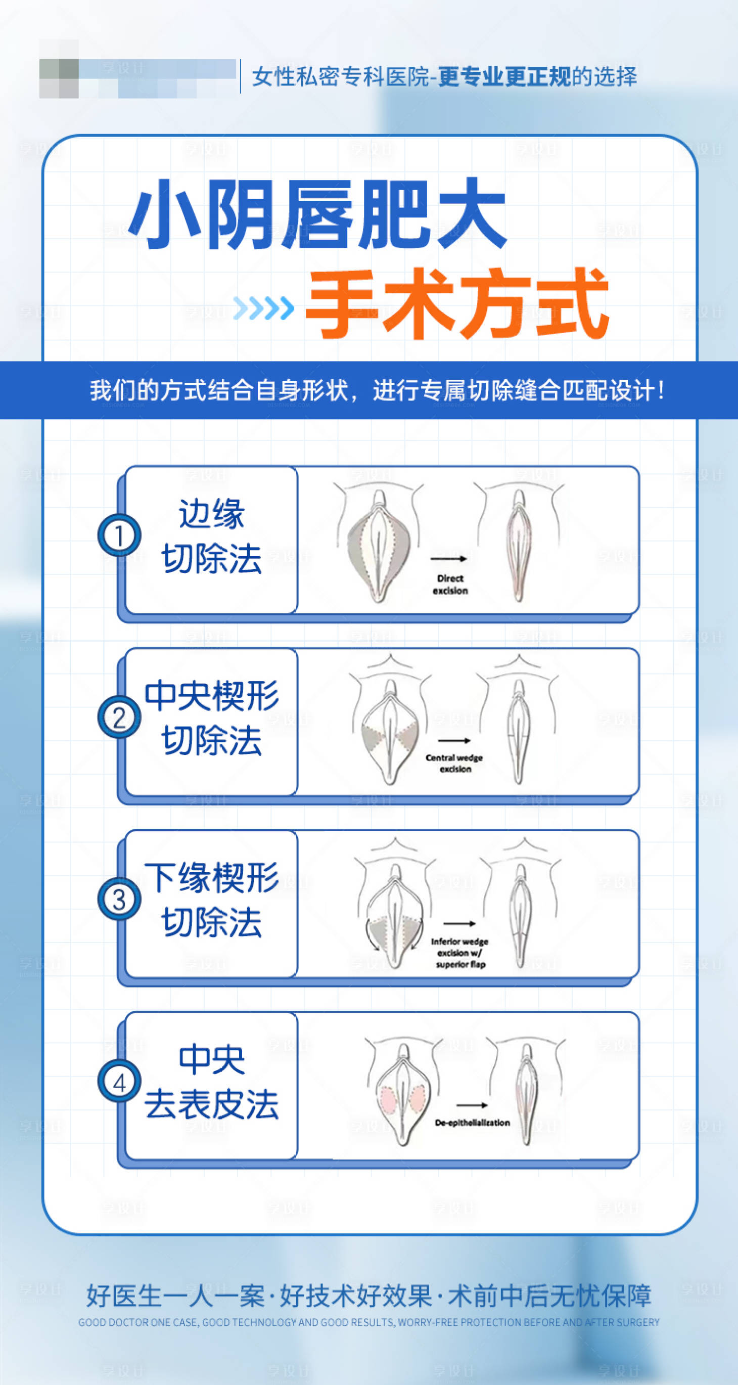 源文件下载【享设计】搜索编号：79660036236479833【小Y唇美型矫正1108】