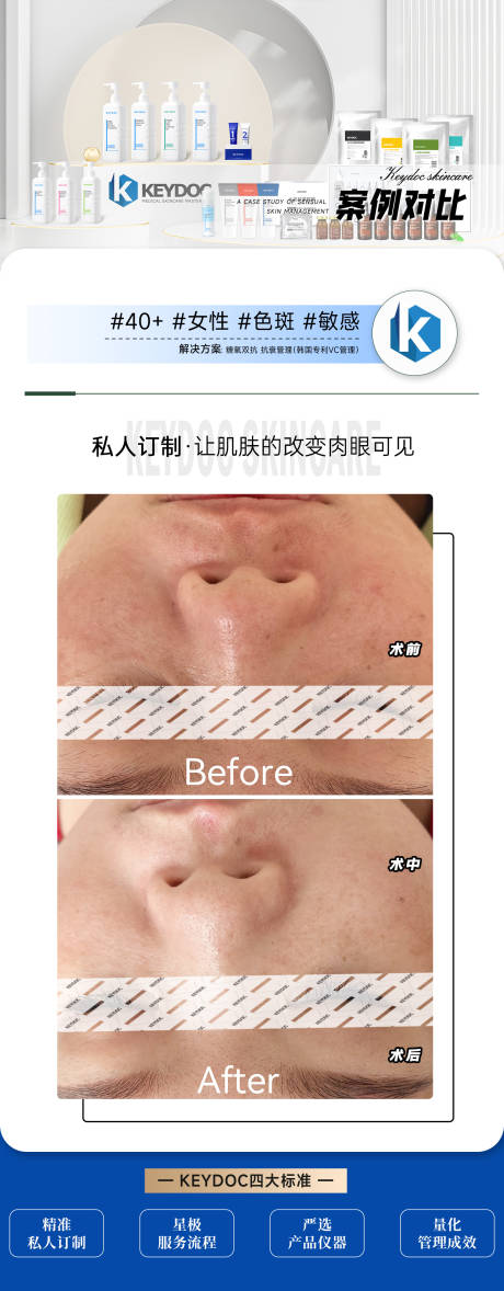 源文件下载【享设计】搜索编号：47910036172369015【效果对比图】