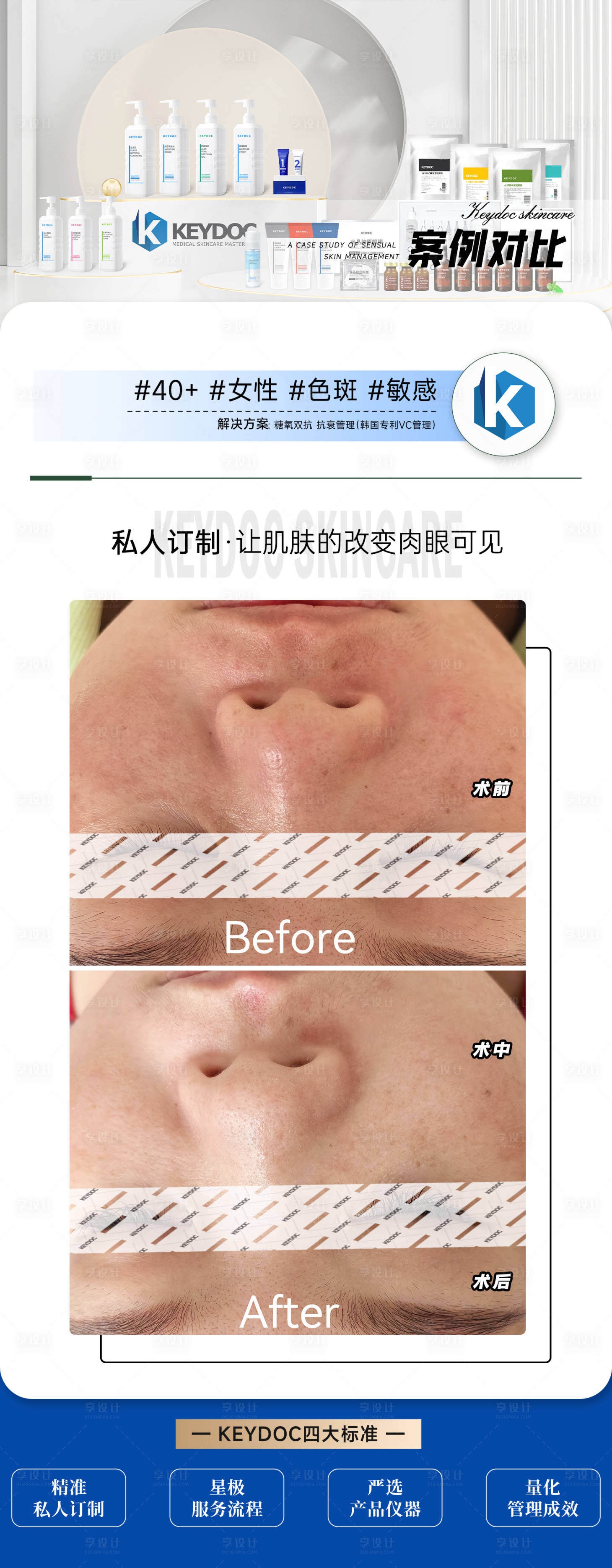 源文件下载【享设计】搜索编号：47910036172369015【效果对比图】