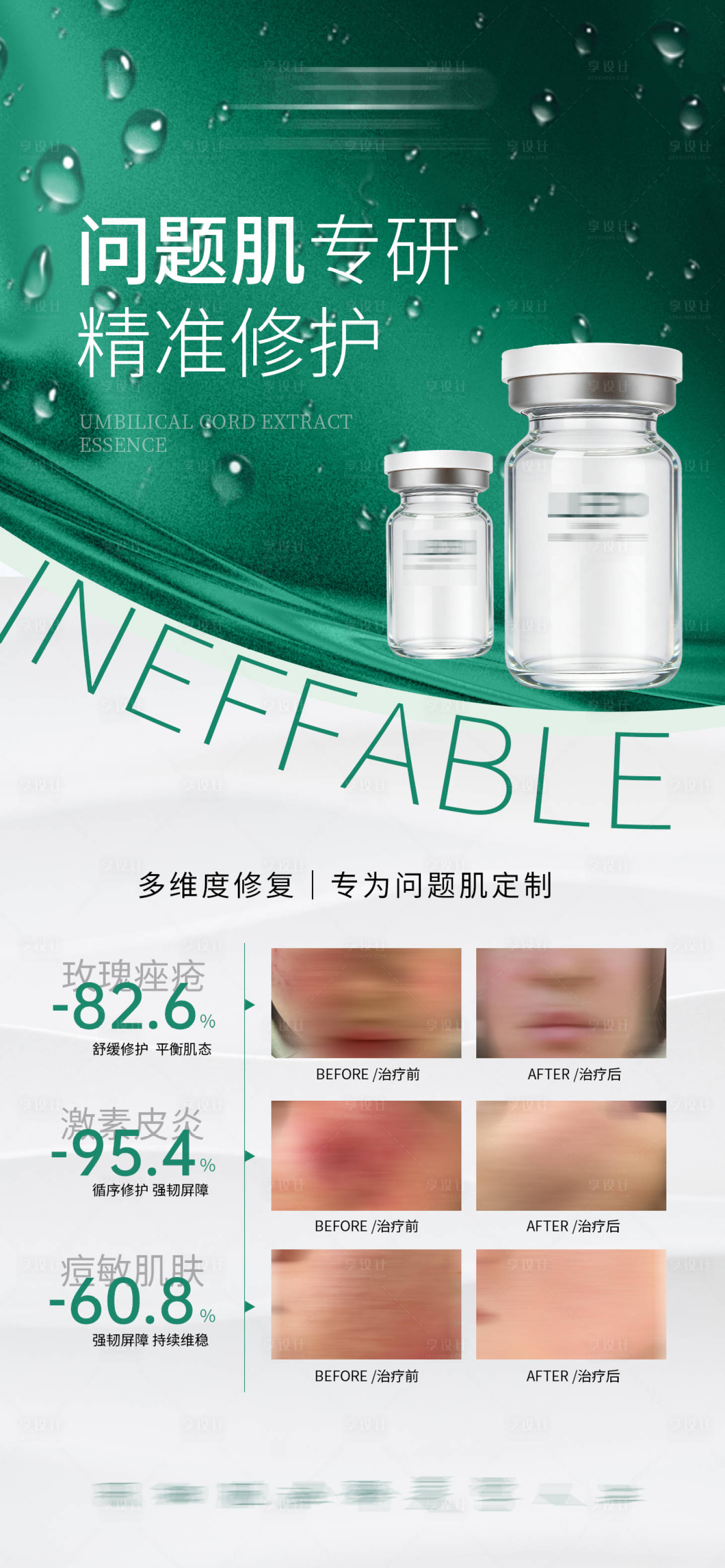 源文件下载【享设计】搜索编号：93250036290298188【医美海报】