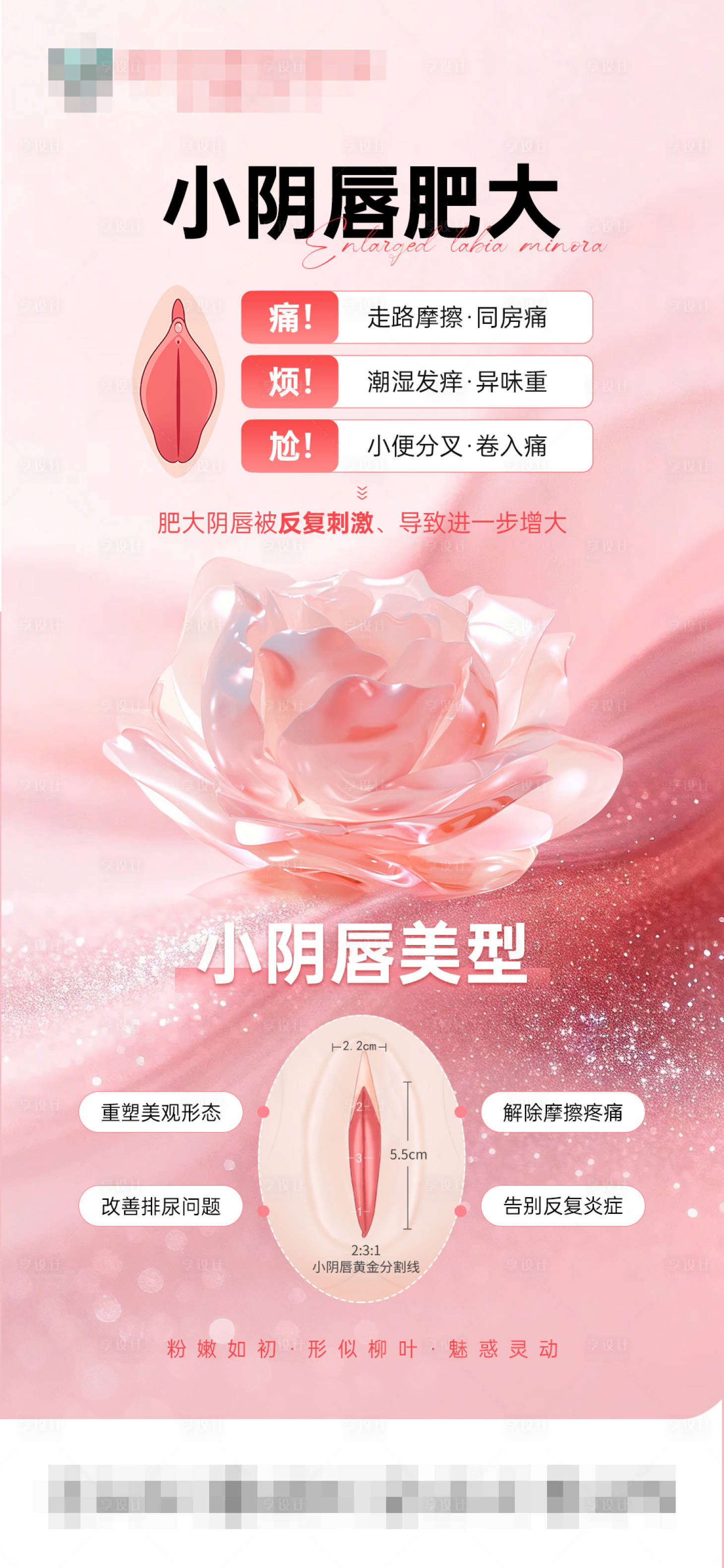 源文件下载【享设计】搜索编号：83420036459495007【小阴唇肥大】