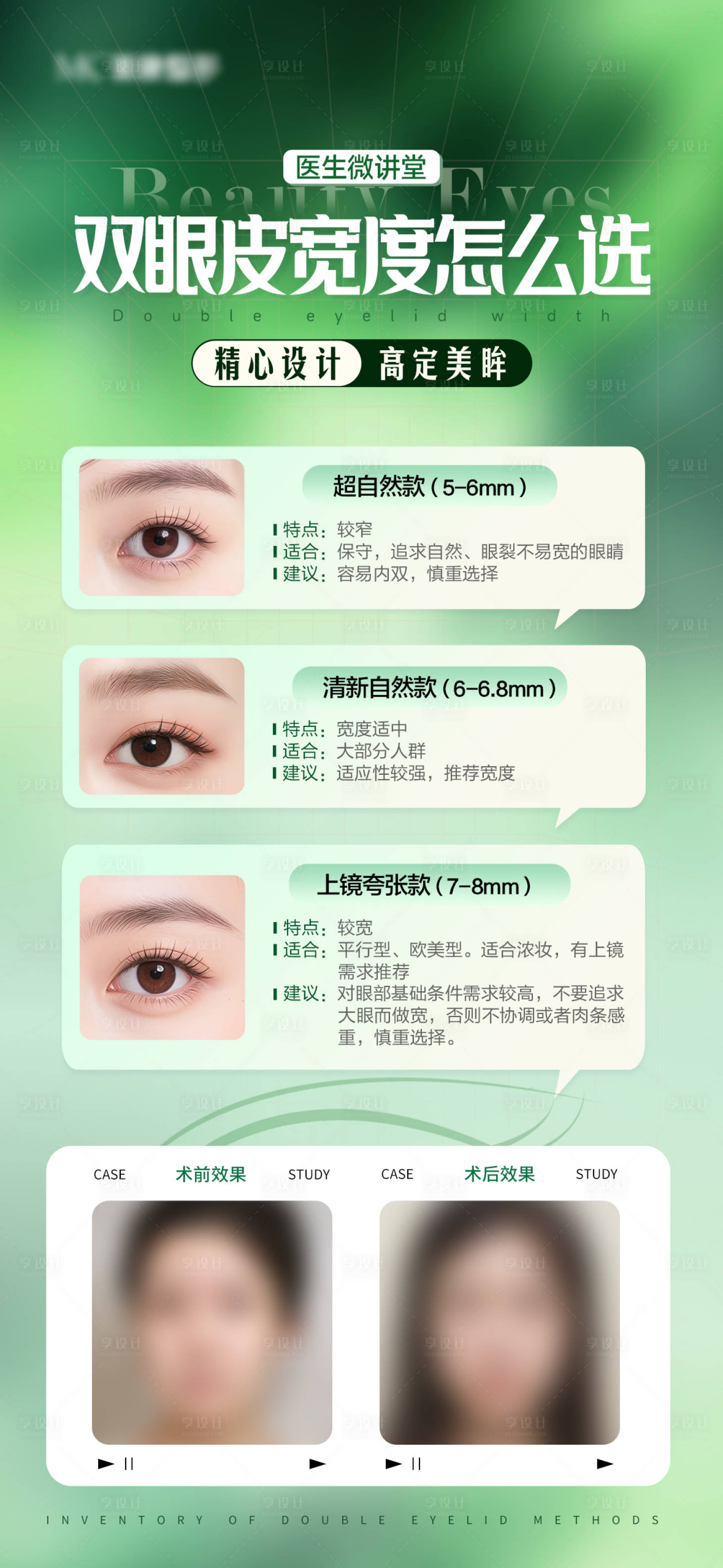 源文件下载【享设计】搜索编号：30840036221768271【医美双眼皮科普海报】