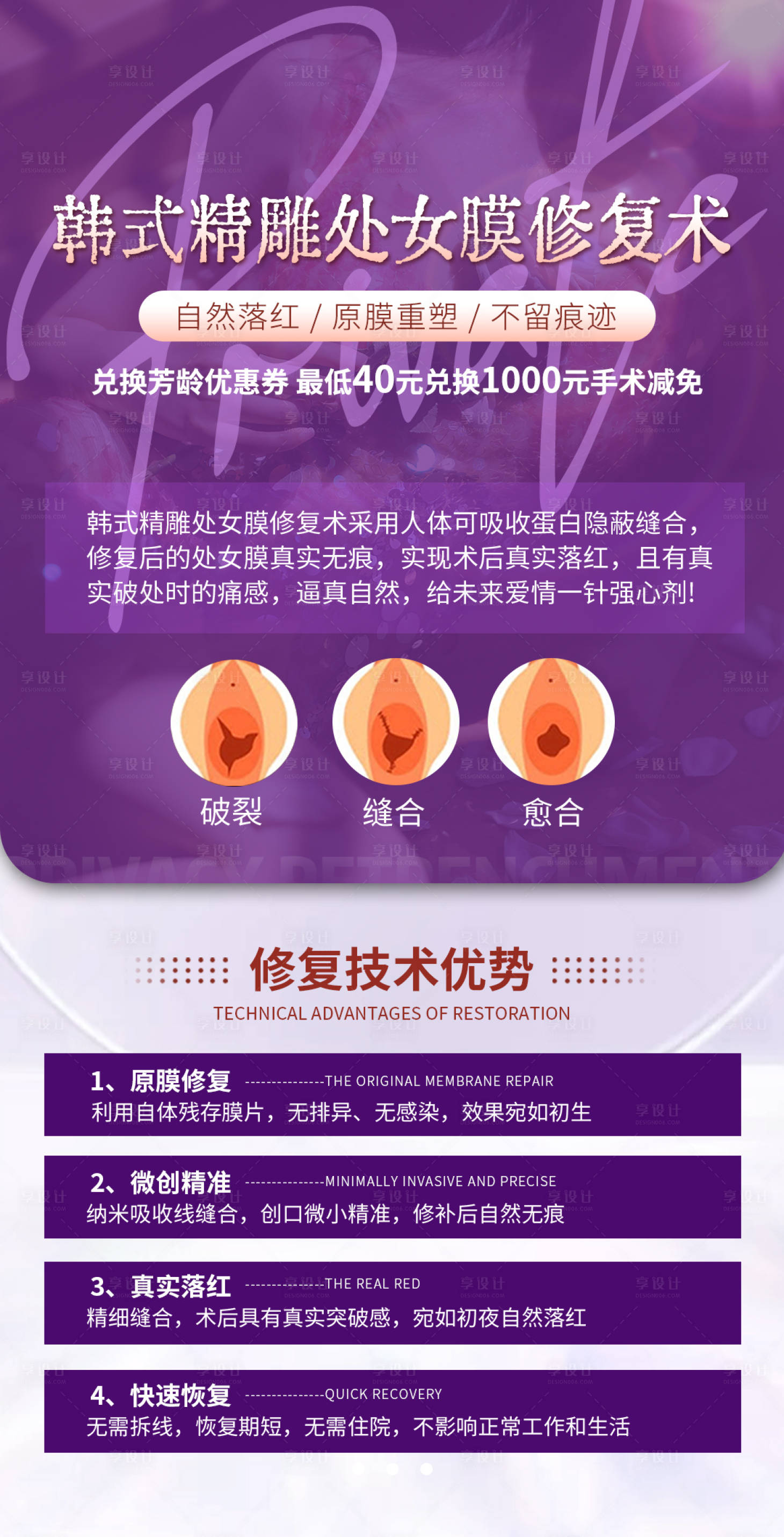 源文件下载【享设计】搜索编号：88310036162529466【处女膜修复的问题】