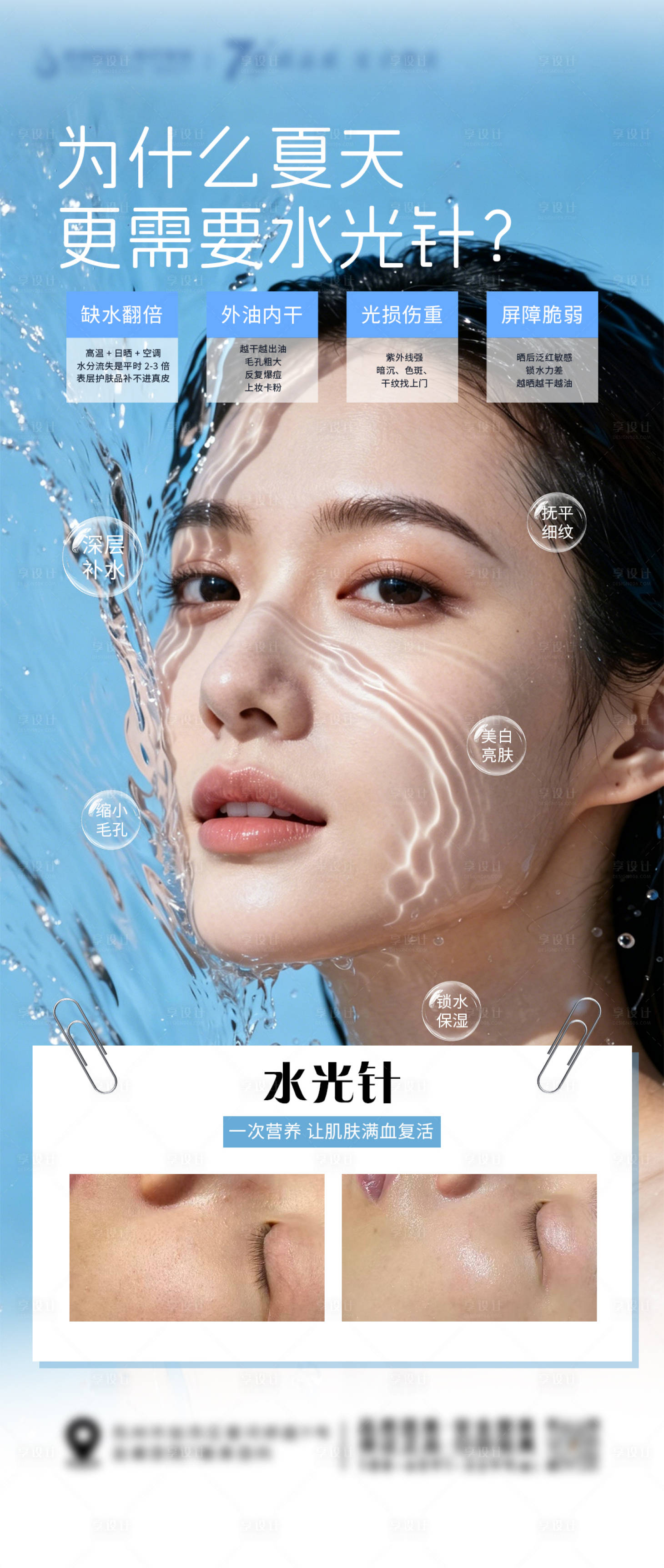 源文件下载【享设计】搜索编号：95470036761989821【为什么夏日更需要打水光针海报】