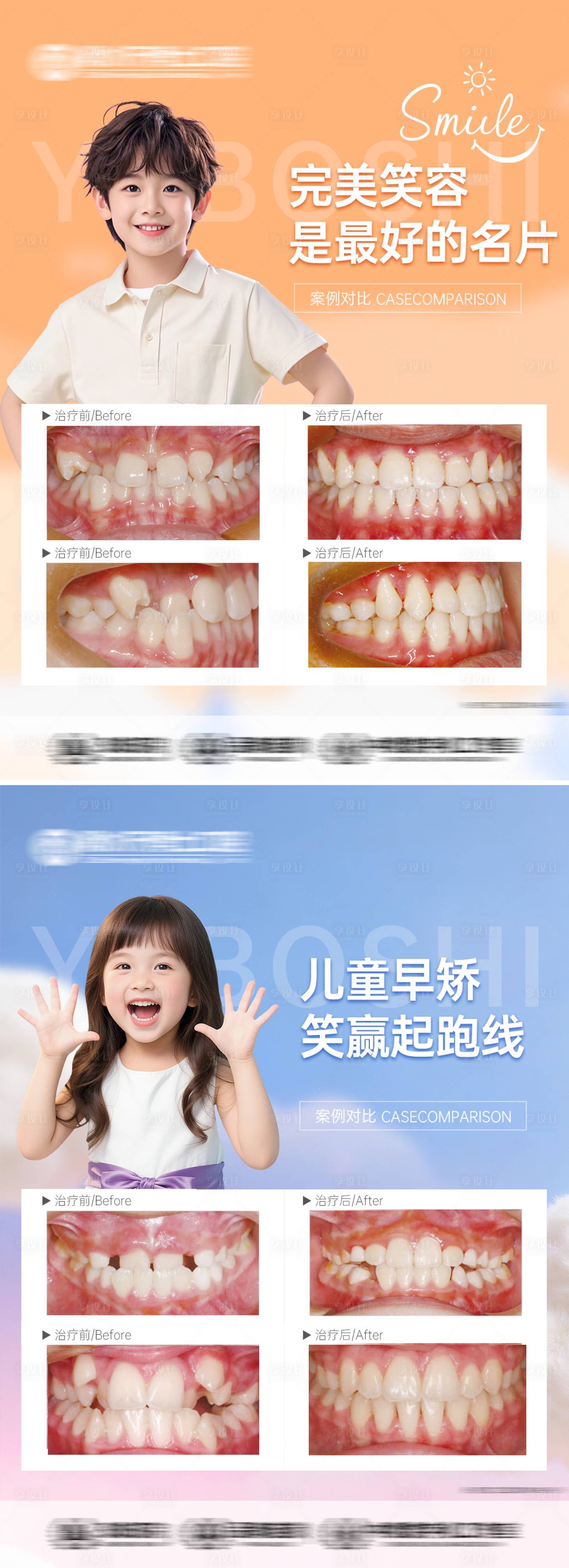 源文件下载【享设计】搜索编号：15690036773077130【儿牙矫正案例对比海报】