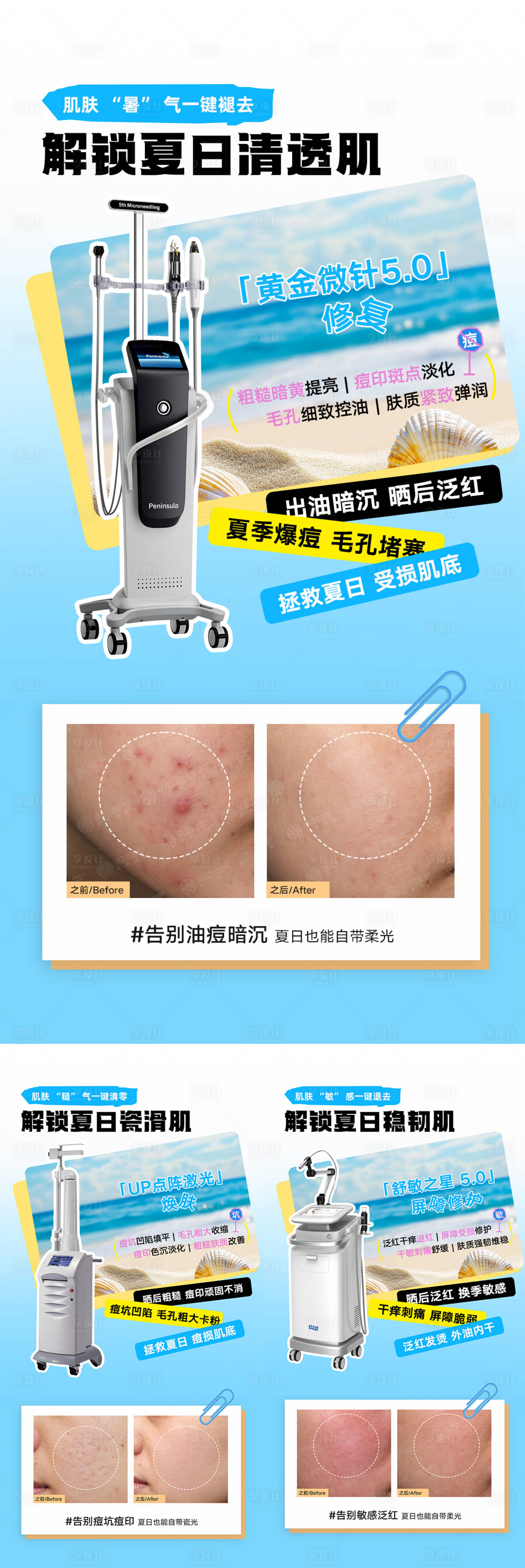 源文件下载【享设计】搜索编号：21970036806428077【半岛黄金微针仪器介绍海报】