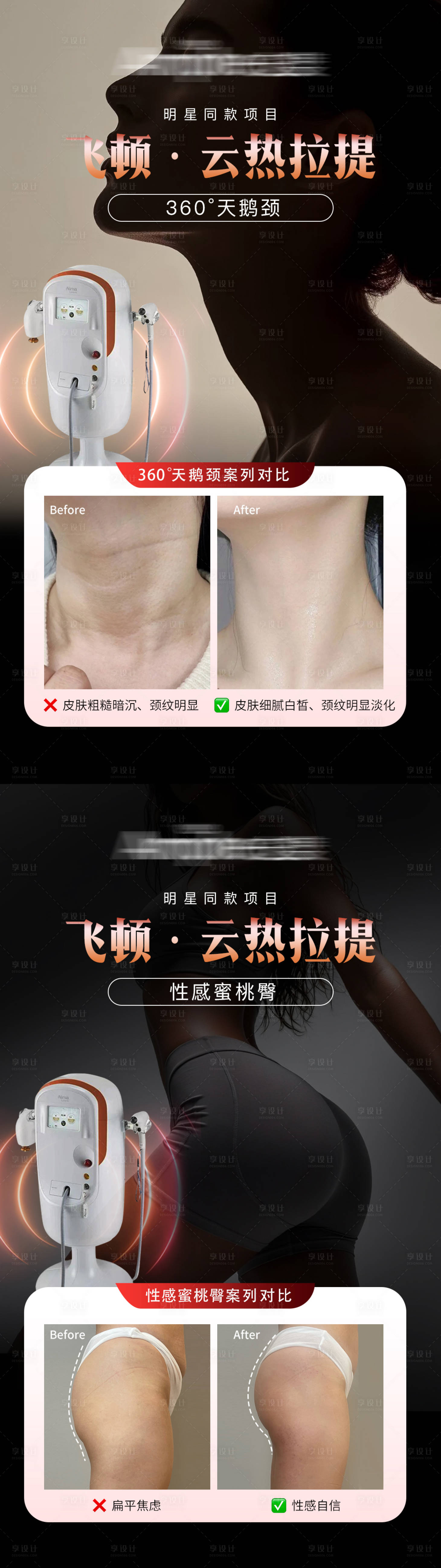 源文件下载【享设计】搜索编号：30940036838519367【飞顿云热拉提活动海报】
