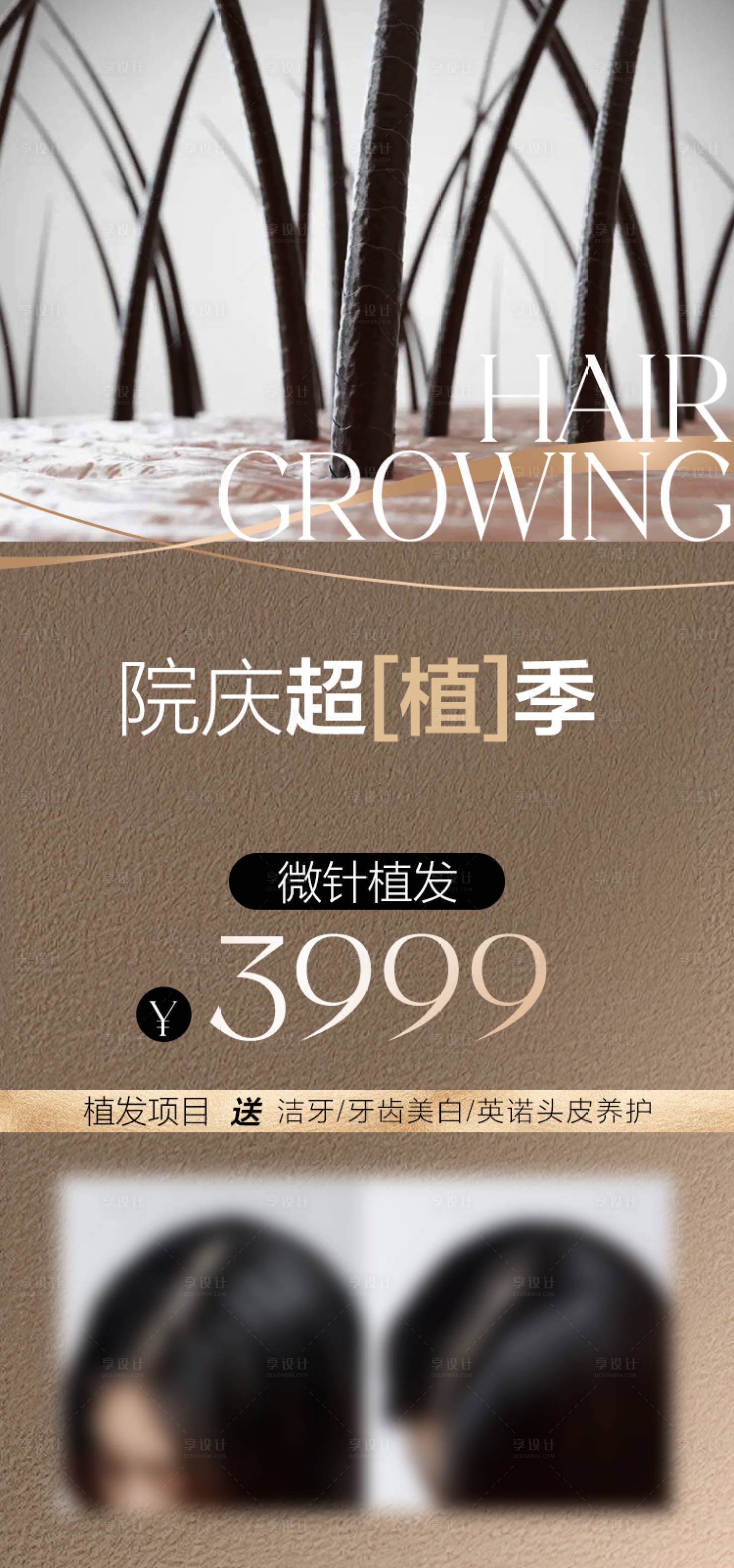源文件下载【享设计】搜索编号：49220036765701900【植发优惠】