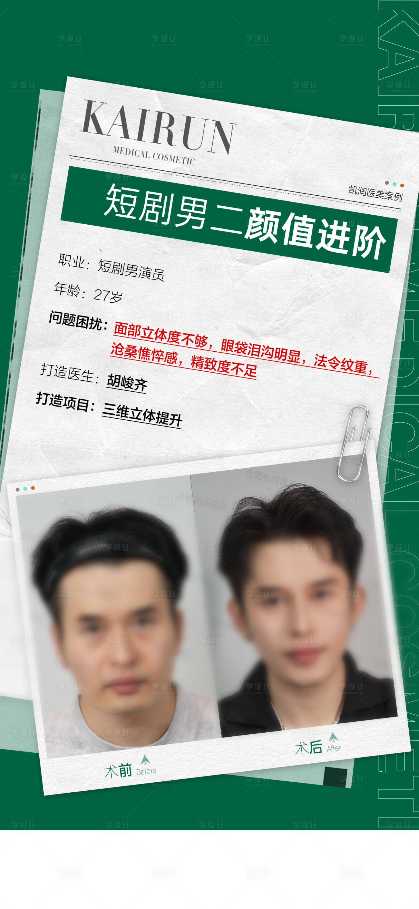 源文件下载【享设计】搜索编号：69490036668078849【医美案例报纸 】